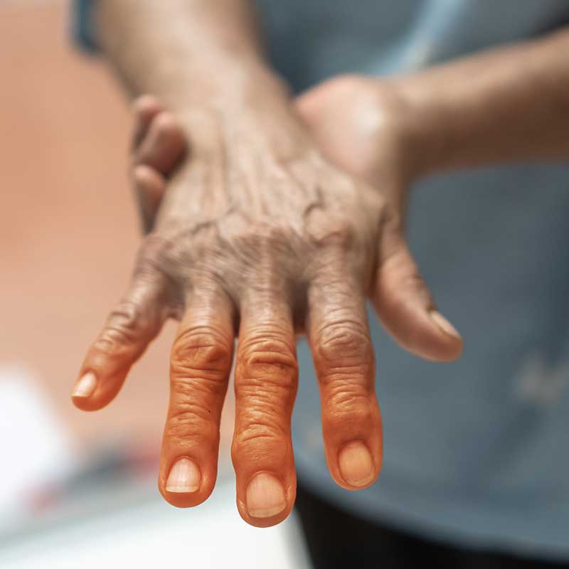 Neuropathy in the hands can be life-altering, but Chronic Care of Richmond can help with neuropathy pain treatment in Richmond.