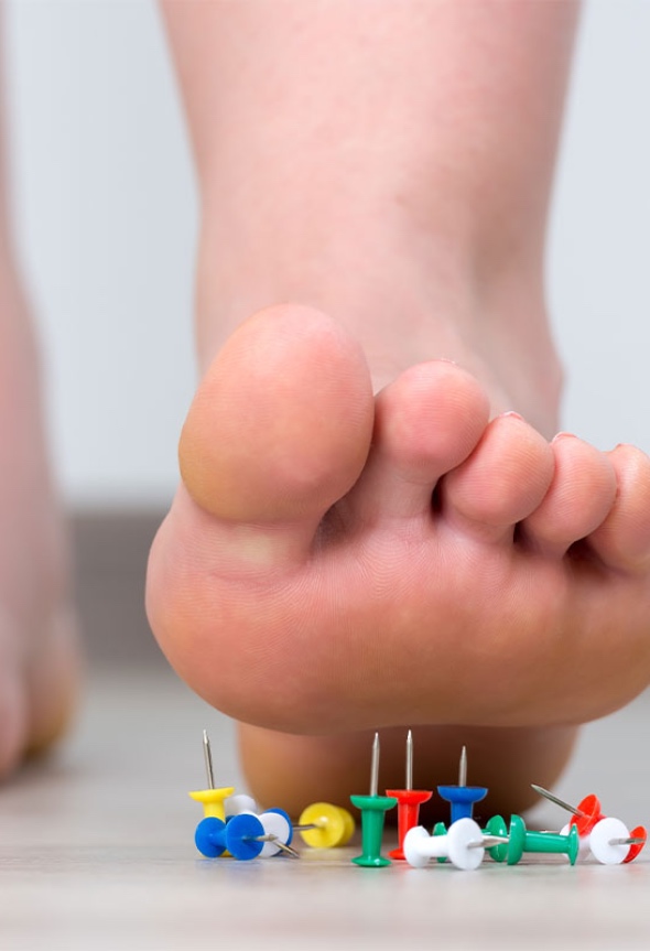Foot neuropathy can feel like this foot stepping on tacks - get foot neuropathy treatment in Richmond with Chronic Care today!
