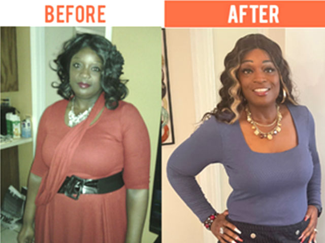 Yolaunda F. - Lost 43 pounds in 8 weeks!